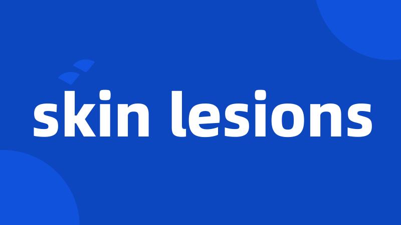 skin lesions