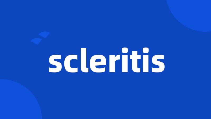 scleritis