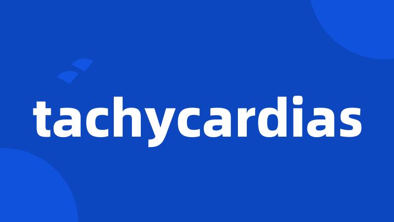 tachycardias