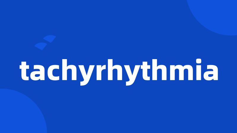 tachyrhythmia
